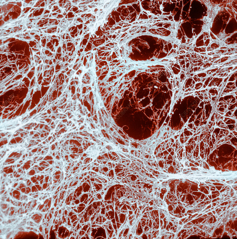The Unsung Hero: Plasmin's Crucial Role in Fibrin Breakdown